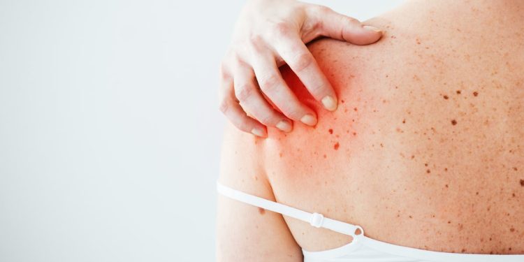 Sinirsel kaşıntı belirtileri nedir, nasıl tedavi edilir?